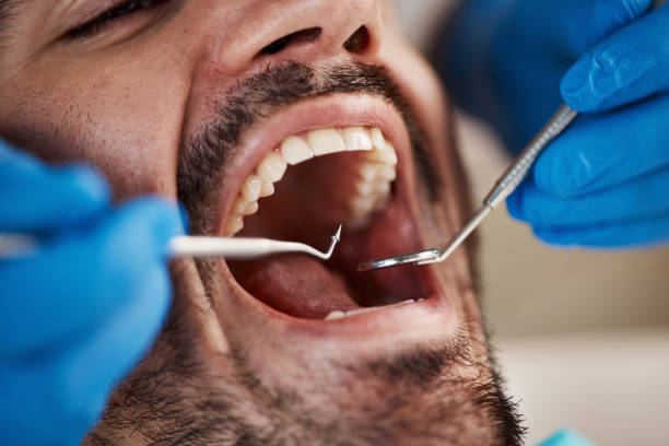 Best Broken or Cracked Tooth Emergency Dentist in Weston Lakes, TX